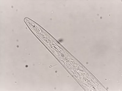 SESVanderHave suikerbieten - wortelknobbelaaltjes chitwoodi meloidogyne - aardappelplaag